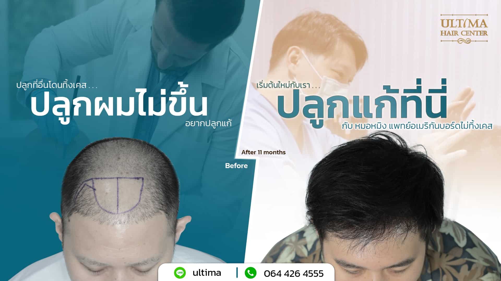 Ultima Hair Center